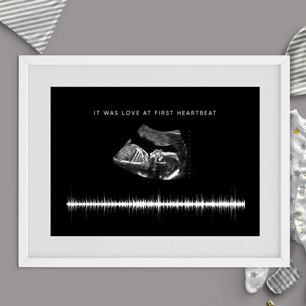 Sound Wave | Baby Scan Heartbeat